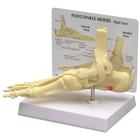 Foot/Ankle - Plantar Fasciitis Model, 1019522, Leg and Foot Skeleton Models (Small)