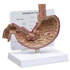 Modelo de Câncer Estomacal, 1019524, Modelo de sistema digestivo