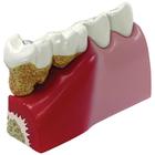 Modelo dos Dentes, 1019539, Modelos dentais
