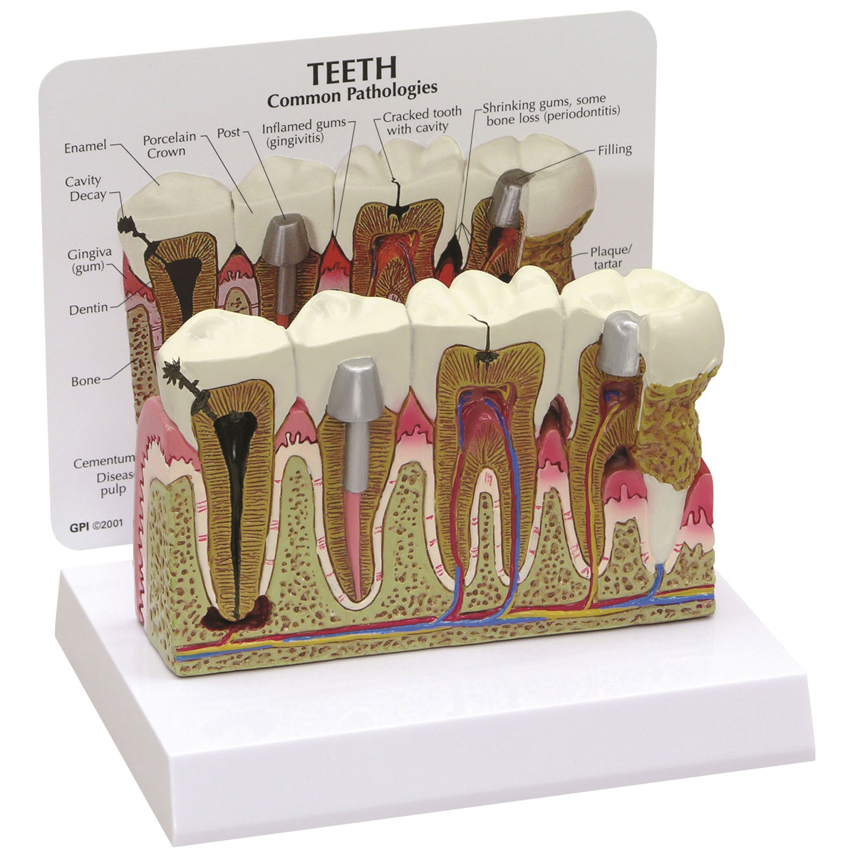 Teeth Model - 1019539 - 2860 - Anatomical Tooth Models - Anatomy