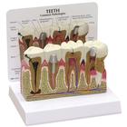 Teeth Model, 1019539, Dental Models (Small)