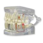 Modelo de mandíbula humana transparente con dientes, 1019540, Modelos dentales