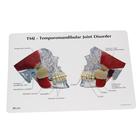TMJ Model, 1019541, Dental Models (Small)