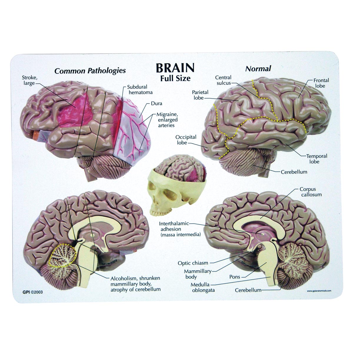 Modelo de cerebro 2900 de GPI, modelo de cerebro humano, Modelo de cerebro