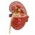 Diseased Kidney Model, 1019550, Digestive System Models (Small)
