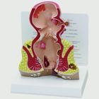 Rectum cross section (oversize) with pathologies, 1019557, Digestive System Models
