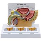 Pelve Masculina com Quadro 3D da Próstata, 1019563, Modelo de genitália e pelve