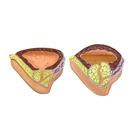 Male Pelvis BPH Model, 1019564, Genital and Pelvis Models (Small)