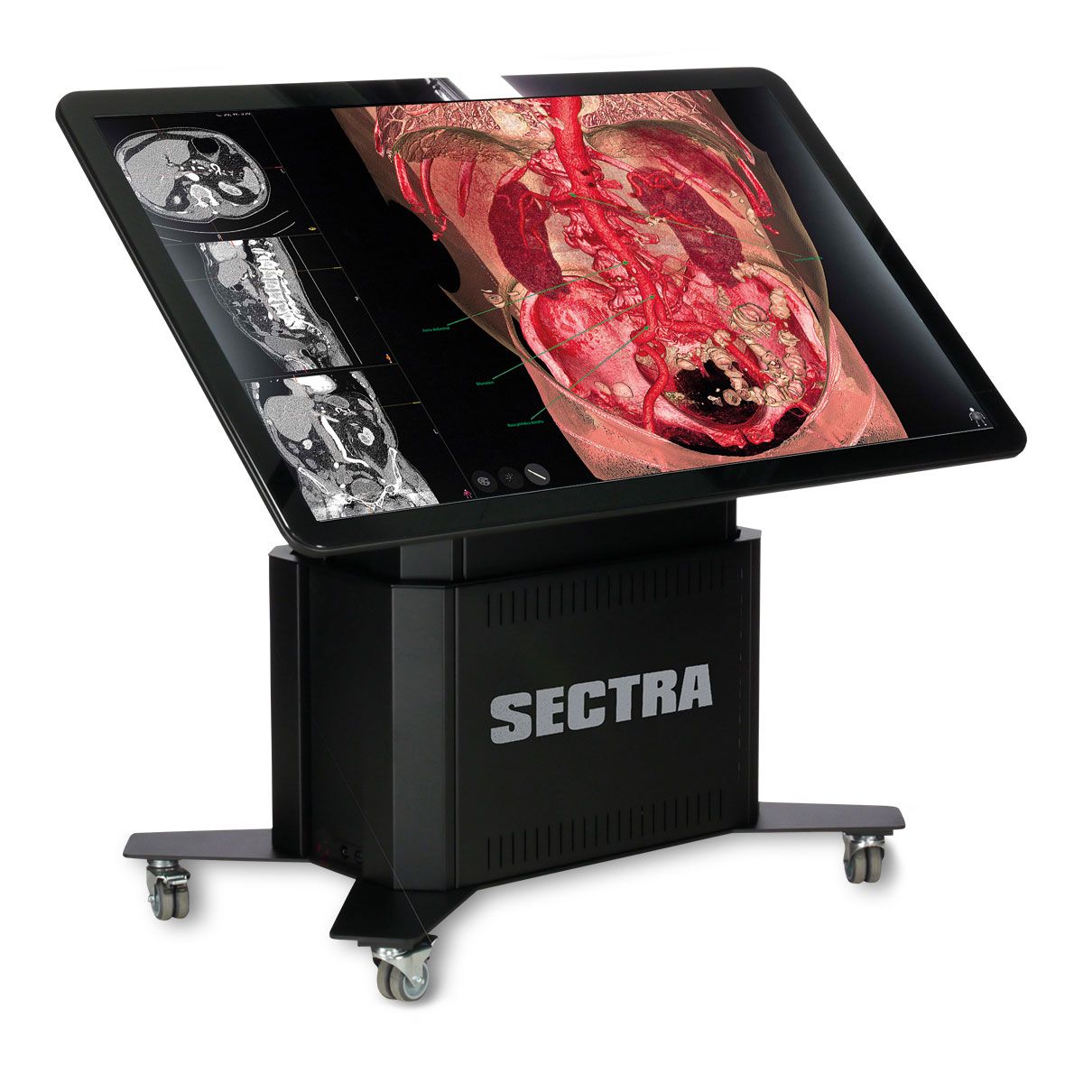 Virtual Anatomy Dissection : Online Dissection Resources – KDUH