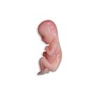 Lifecast Miscarriage Manikins, 1024667, Obstetrics (Small)