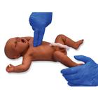 Bébé à terme Africain / Homme
, 1024674, Réanimation ALS nourrisson