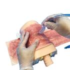 Pele para Cricotireoidotomia com Queimadura devido &agrave; Radioterapia., 1025390, Gest&atilde;o das vias a&eacute;reas adulto
 (Small)