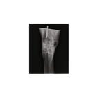 Equine Radiology Limb, 1025582, Equine Simulators (Small)