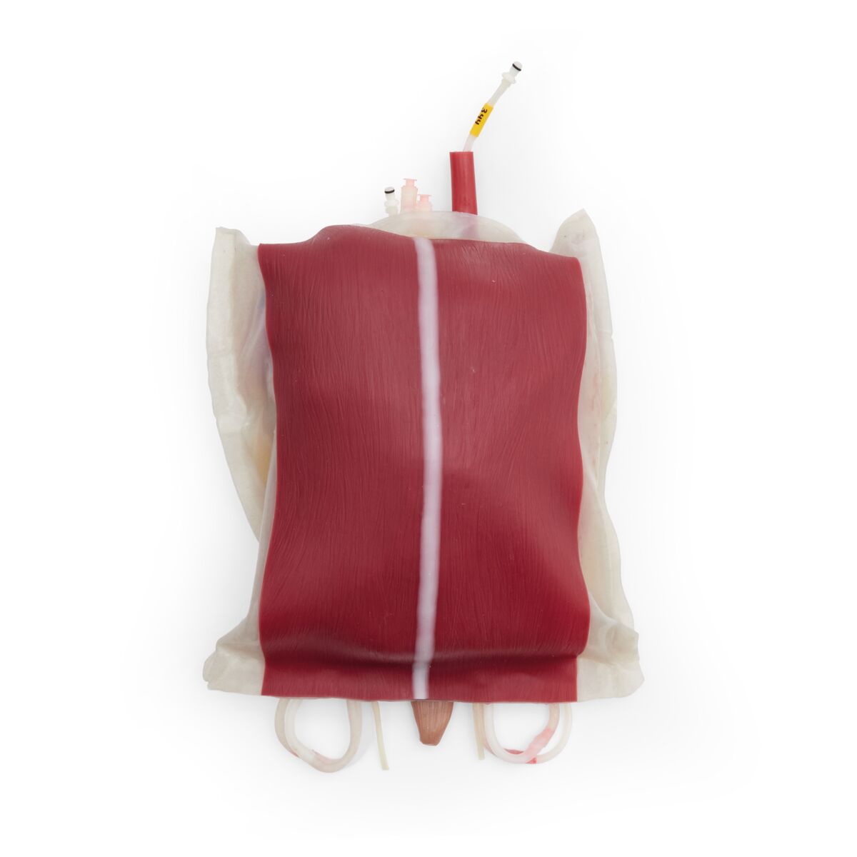 ASSP para OS3 – Paquete Abdominal | 1025868 | STOPS Medical | OS3-ASSP ...