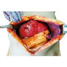 Open Surgical Simulation System (OS3), 1025950, Surgical Procedures Training (Small)