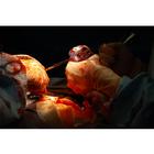 Surgical Cut Suit (TCCC/EMS Capabilities) - Light Skin, 1025958, Surgical Procedures Training (Small)