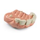 Equine Upper Incisors, 1026516, Equine Simulators (Small)