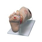 Vinnie Venous Insufficiency Leg&nbsp;, 1022185 [3001176], Adult Patient Care (Small)