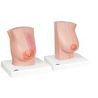 Breast Examination Set, 8000875 [3011613], Anatomical Model Sets (Small)