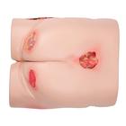 Wound Care Basic Set, 8000880 [3011907], Simulation Starter Kits (Small)