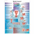 Contraceptive Set, Dark, 8000885 [3011911], Simulation Starter Kits (Small)