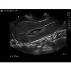 Blue Phantom Combo Intrauterine and Ectopic Pregnancy Transvaginal Ultrasound Training Model, 3012465, Entrenadores de habilidades de ultrasonido (Small)