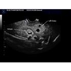 Blue Phantom Combo Intrauterine and Ectopic Pregnancy Transvaginal Ultrasound Training Model, 3012465, Entrenadores de habilidades de ultrasonido (Small)
