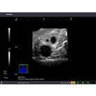 Blue Phantom Combo Intrauterine and Ectopic Pregnancy Transvaginal Ultrasound Training Model, 3012465, Entrenadores de habilidades de ultrasonido (Small)