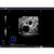 Blue Phantom Combo Intrauterine and Ectopic Pregnancy Transvaginal Ultrasound Training Model, 3012465, Ultrasound Skill Trainers (Small)