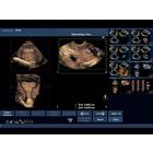 Blue Phantom Combo Intrauterine and Ectopic Pregnancy Transvaginal Ultrasound Training Model, 3012465, Entrenadores de habilidades de ultrasonido (Small)