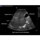 Blue Phantom FAST Ultrasound Training Model Includes Full Body Torso, 3012470, Ultrasound Skill Trainers (Small)