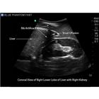 Blue Phantom FAST Ultrasound Training Model Includes Full Body Torso, 3012470, Ultrasound Skill Trainers (Small)