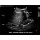Blue Phantom FAST Ultrasound Training Model Includes Full Body Torso, 3012470, Ultrasound Skill Trainers (Small)