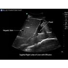 Blue Phantom FAST Ultrasound Training Model Includes Full Body Torso, 3012470, Ultrasound Skill Trainers (Small)