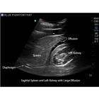 Blue Phantom FAST Ultrasound Training Model Includes Full Body Torso, 3012470, Ultrasound Skill Trainers (Small)