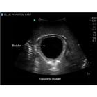 Blue Phantom FAST Ultrasound Training Model Includes Full Body Torso, 3012470, Ultrasound Skill Trainers (Small)