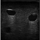 Blue Phantom Gen II PICC with I.V. and Arterial Line Ultrasound Training Model, 3012493, Ultrasound Skill Trainers (Small)