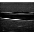 Blue Phantom Gen II PICC with I.V. and Arterial Line Ultrasound Training Model, 3012493, Ultrasound Skill Trainers (Small)