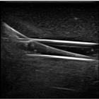 Blue Phantom Gen II PICC with I.V. and Arterial Line Ultrasound Training Model, 3012493, Ultrasound Skill Trainers (Small)
