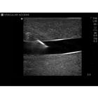 Blue Phantom Internal Jugular Central Line Ultrasound Manikin, 3012495, Ultrasound Skill Trainers (Small)