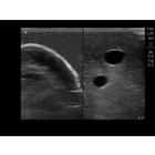 Blue Phantom Internal Jugular Central Line Ultrasound Manikin, 3012495, Ultrasound Skill Trainers (Small)