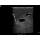 Blue Phantom Internal Jugular Central Line Ultrasound Manikin, 3012495, Ultrasound Skill Trainers (Small)