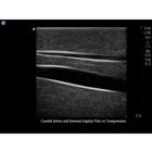 Blue Phantom Internal Jugular Central Line Ultrasound Manikin, 3012495, Ultrasound Skill Trainers (Small)