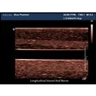 Blue Phantom Regional Anesthesia Ultrasound Training Block Model, 3012506, Entrenadores de habilidades de ultrasonido (Small)