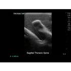 Blue Phantom Spinal Epidural, Lumbar Puncture and Cervical Epidural Training Model, 3012514, Ultrasound Skill Trainers (Small)