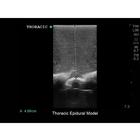 Blue Phantom Spinal Epidural and Lumbar Puncture Training Model, 3012516, Ultrasound Skill Trainers (Small)