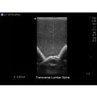 Blue Phantom Spinal Epidural and Lumbar Puncture Training Model, 3012516, Ultrasound Skill Trainers (Small)