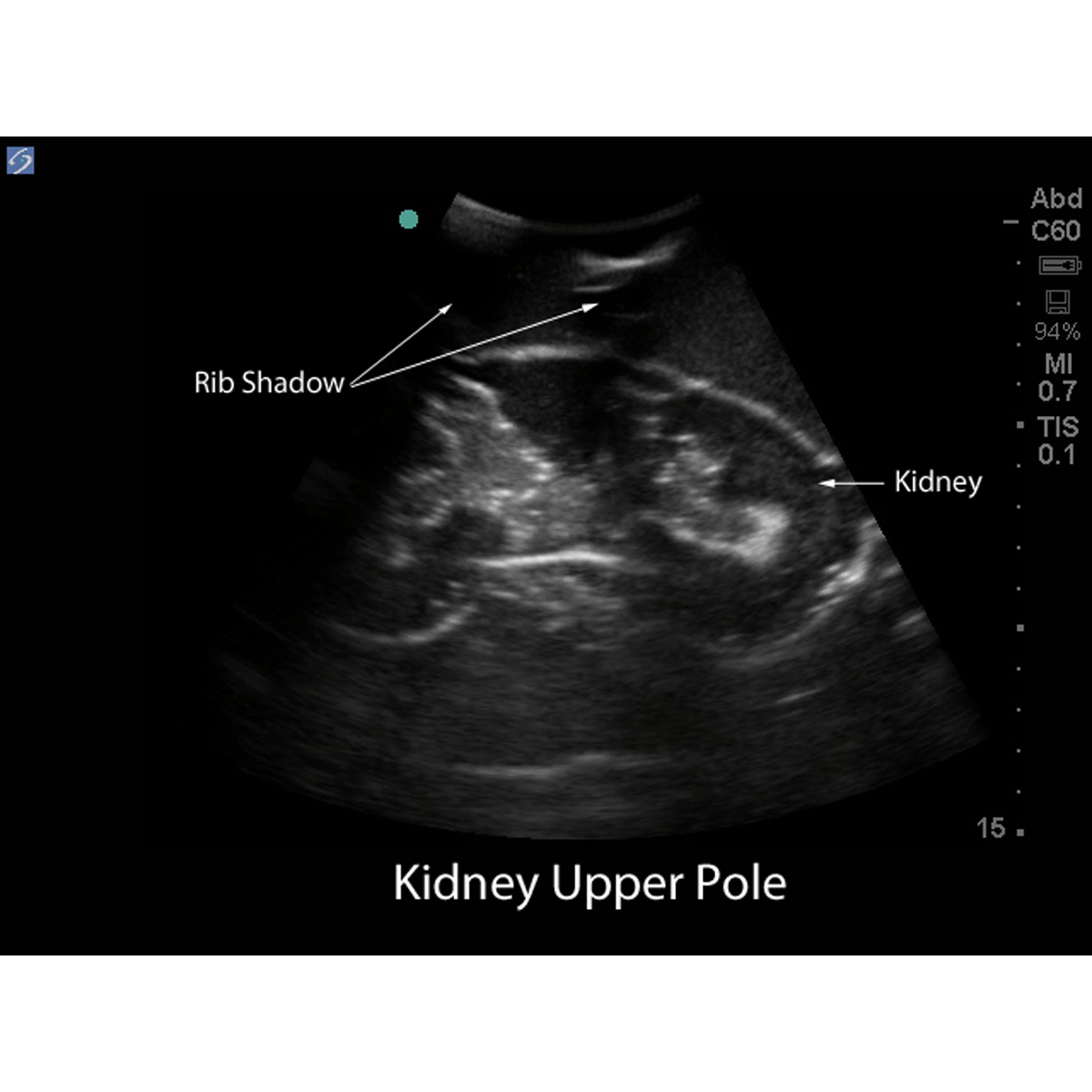 Blue Phantom Renal Biopsy Model Replacement Kidneys Inserts | 3012587 ...