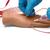 
	
		
			
				Peripheral Intravenous (IV) Catheterization Hand Simulator, Medium
		
	

, 3017002, Intravenoso (IV) y arterial (Small)