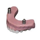 Dientes inferiores pedi&aacute;tricos, 1026944 [3018461], Repuestos (Small)
